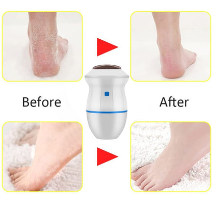 Foot Care Tool Electric Grinder Machine Foot Dead Skin Exfoliator